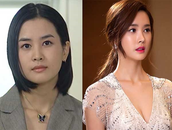 Giải đáp nỗi sợ hãi... xương mọc lại sau gọt mặt