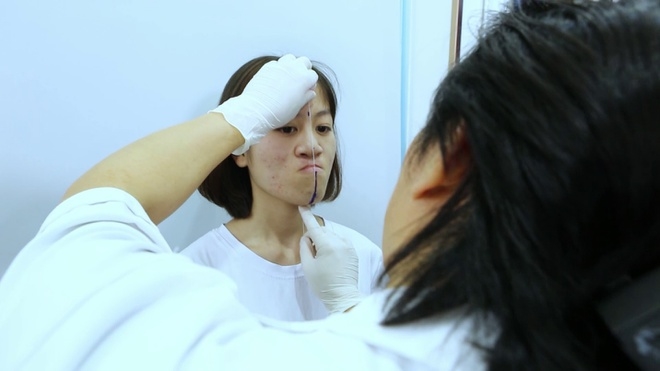 Hành trình đổi mới diện mạo của cô gái 'miệng hứng mưa'