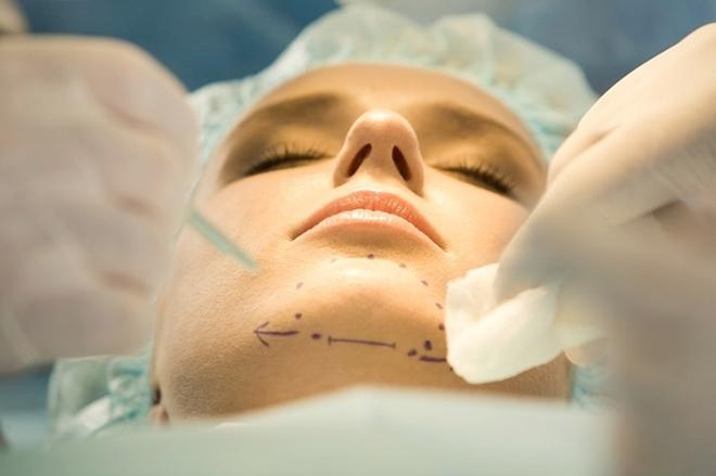 Trượt cằm vốn phức tạp và có rủi ro biến chứng cao, vậy chị em cần lưu ý điều gì?