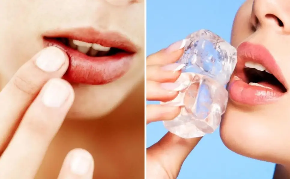 Chườm đá lạnh giảm sưng môi