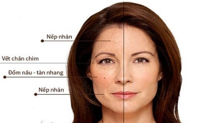 Gương mặt, làn da ở phụ nữ sau tuổi 40 sẽ có sự thay đổi rõ rệt.