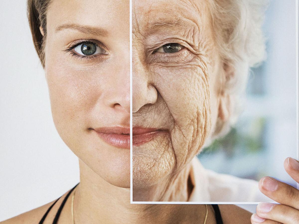 Nếp nhăn là dấu hiệu rõ ràng nhất của sự lão hóa, già trước tuổi.