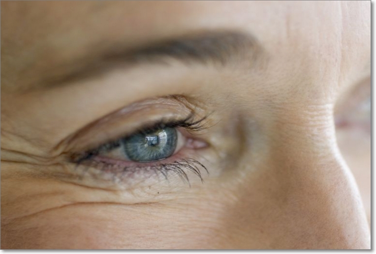 Nếp nhăn ở mắt có thể làm bạn trông già hơn.
