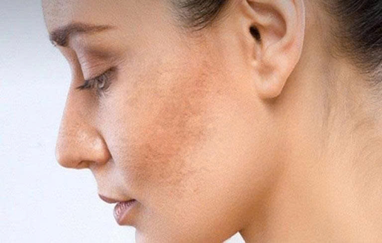Nhiều yếu tố từ bên trong cơ thể đến môi trường bên ngoài có thể khiến da sạm màu, kém tươi tắn