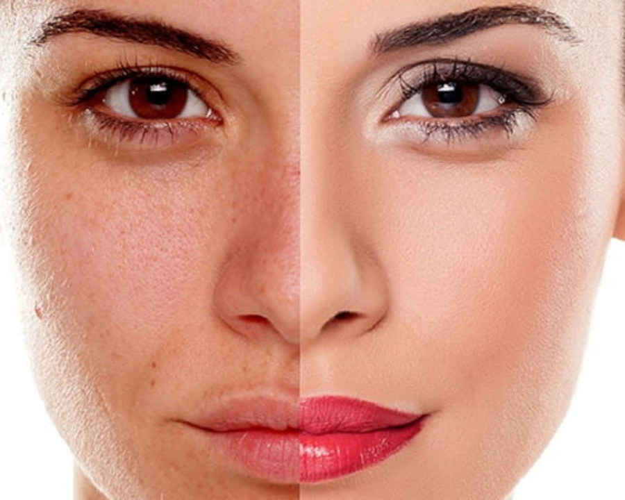 Bảo vệ và chăm sóc da trong ngày hè để làn da luôn được sáng mịn...