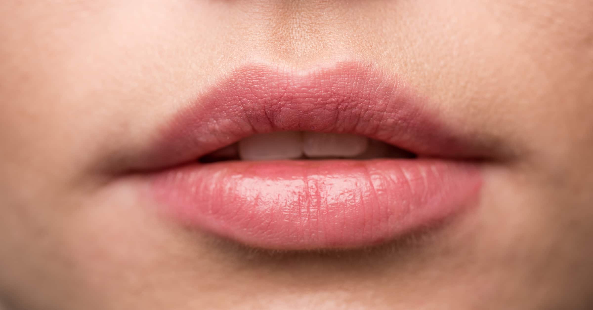 Đôi môi hồng hào không chỉ là biểu tượng của vẻ đẹp rạng rỡ mà còn phản ánh tình trạng sức khỏe tốt.
