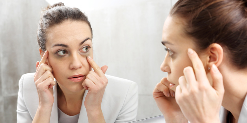 Da vùng mắt mỏng hơn đáng kể, khiến hệ thống mạch máu bên dưới dễ lộ rõ hơn, tạo nên tình trạng thâm quầng.