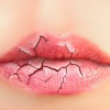 Gợi ý 8 biện pháp khắc phục tại nhà cho môi khô và nứt nẻ