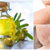 Dầu Mù U - Từ “thuốc trị bỏng” quê nhà đến “vàng xanh” của làn da