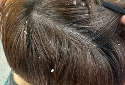 Chăm sóc da đầu khoa học: Khi dược liệu trở thành xu hướng trong chuẩn chăm sóc tóc mới