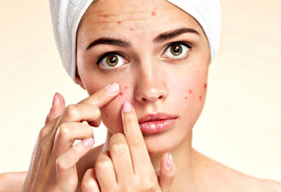 6 thói quen xấu gây mụn trứng cá