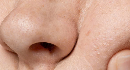 Chăm sóc sức khỏe làn da sau Tết