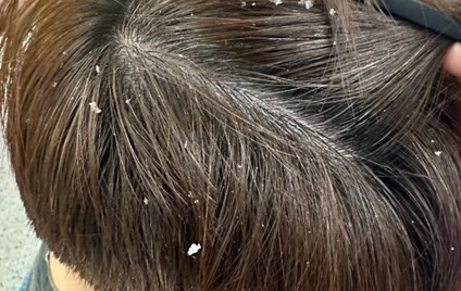 Chăm sóc da đầu khoa học: Khi dược liệu trở thành xu hướng trong chuẩn chăm sóc tóc mới