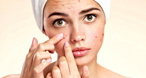 6 thói quen xấu gây mụn trứng cá