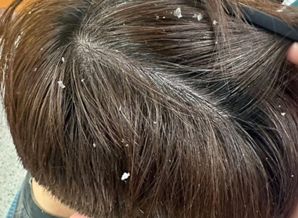 Chăm sóc da đầu khoa học: Khi dược liệu trở thành xu hướng trong chuẩn chăm sóc tóc mới